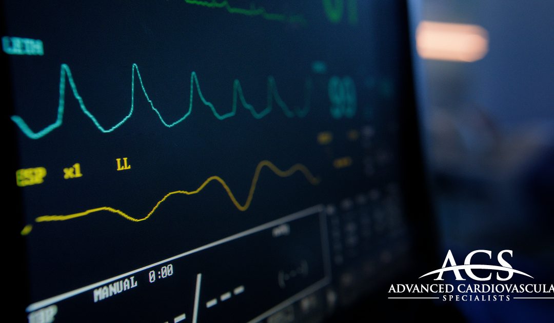 From Flutter To Fibrillation: Arrhythmias Explained